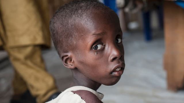 UNICEF: Négy országban 1,4 millió gyereket fenyeget éhhalál